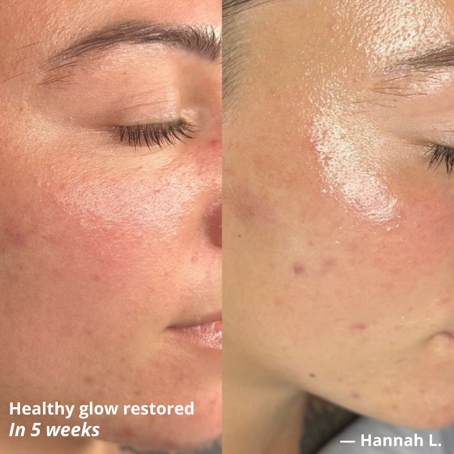 Centella Recovery Serum