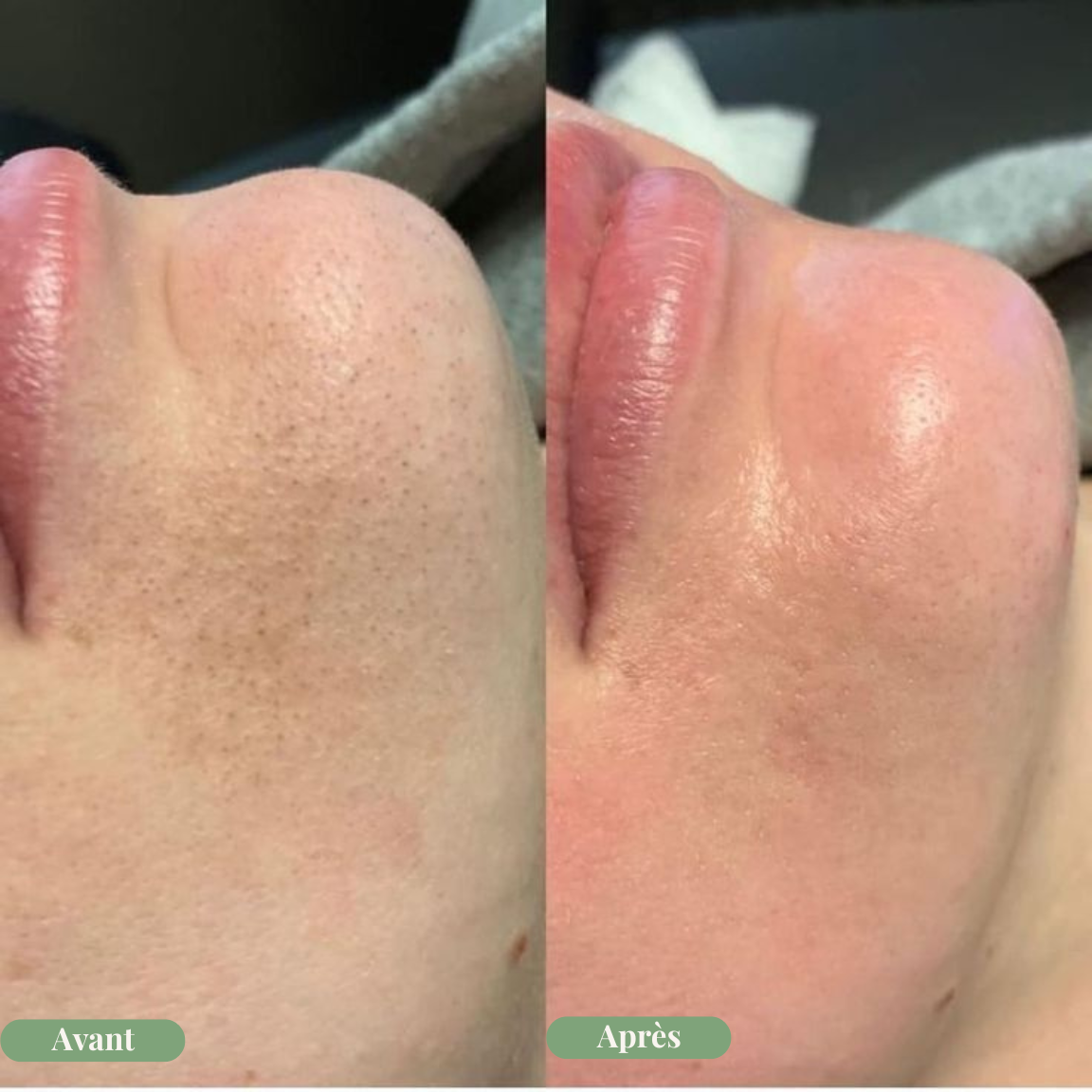 Masque nettoyant à bulles de basilic sacré