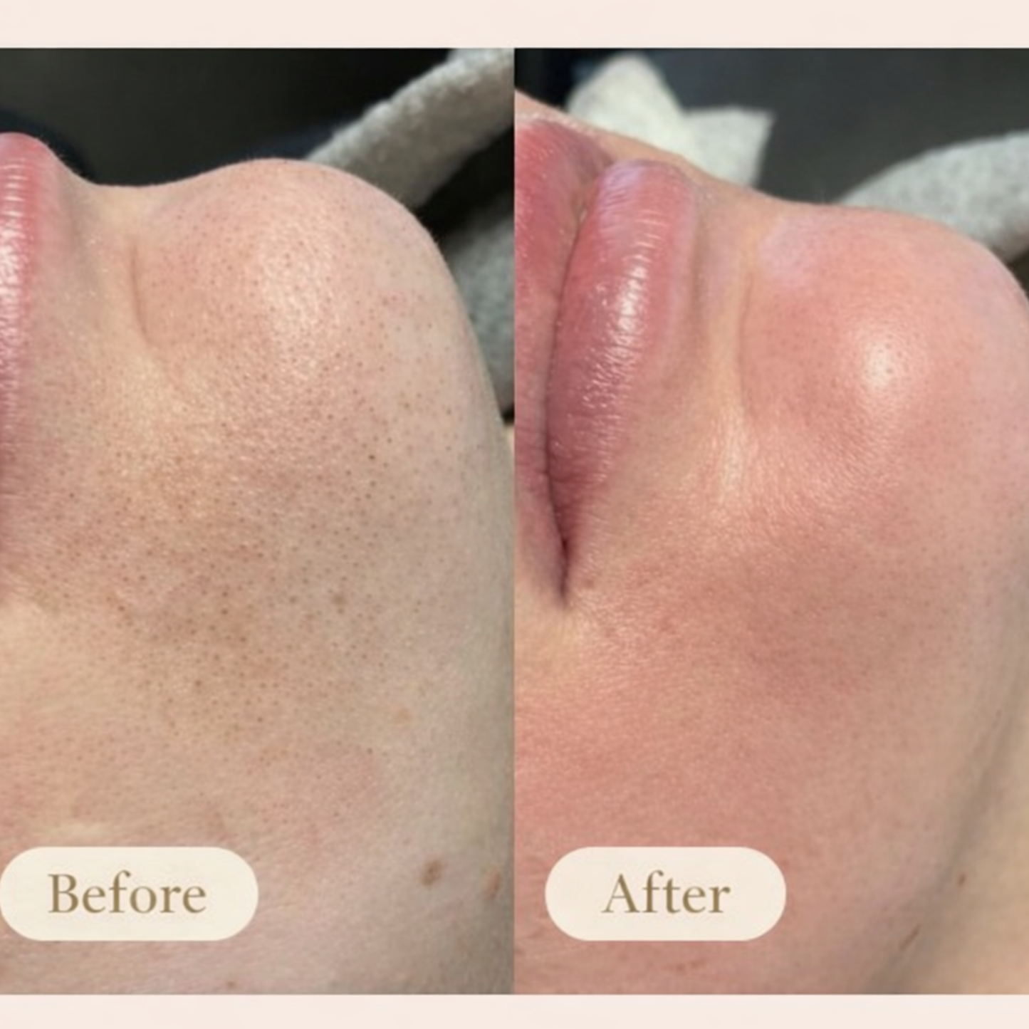 Deep Pore Purifying Mask