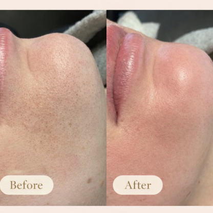 Deep Pore Purifying Mask