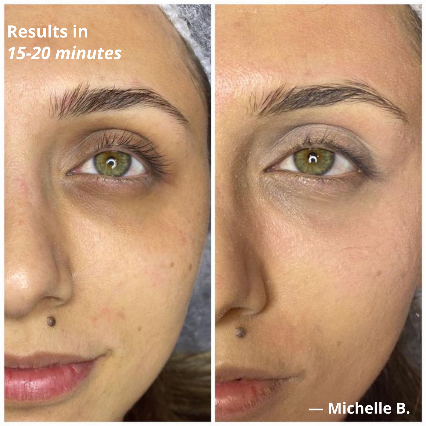 Morning Recovery Eye Patches