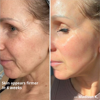 Glass Skin Lifting Device