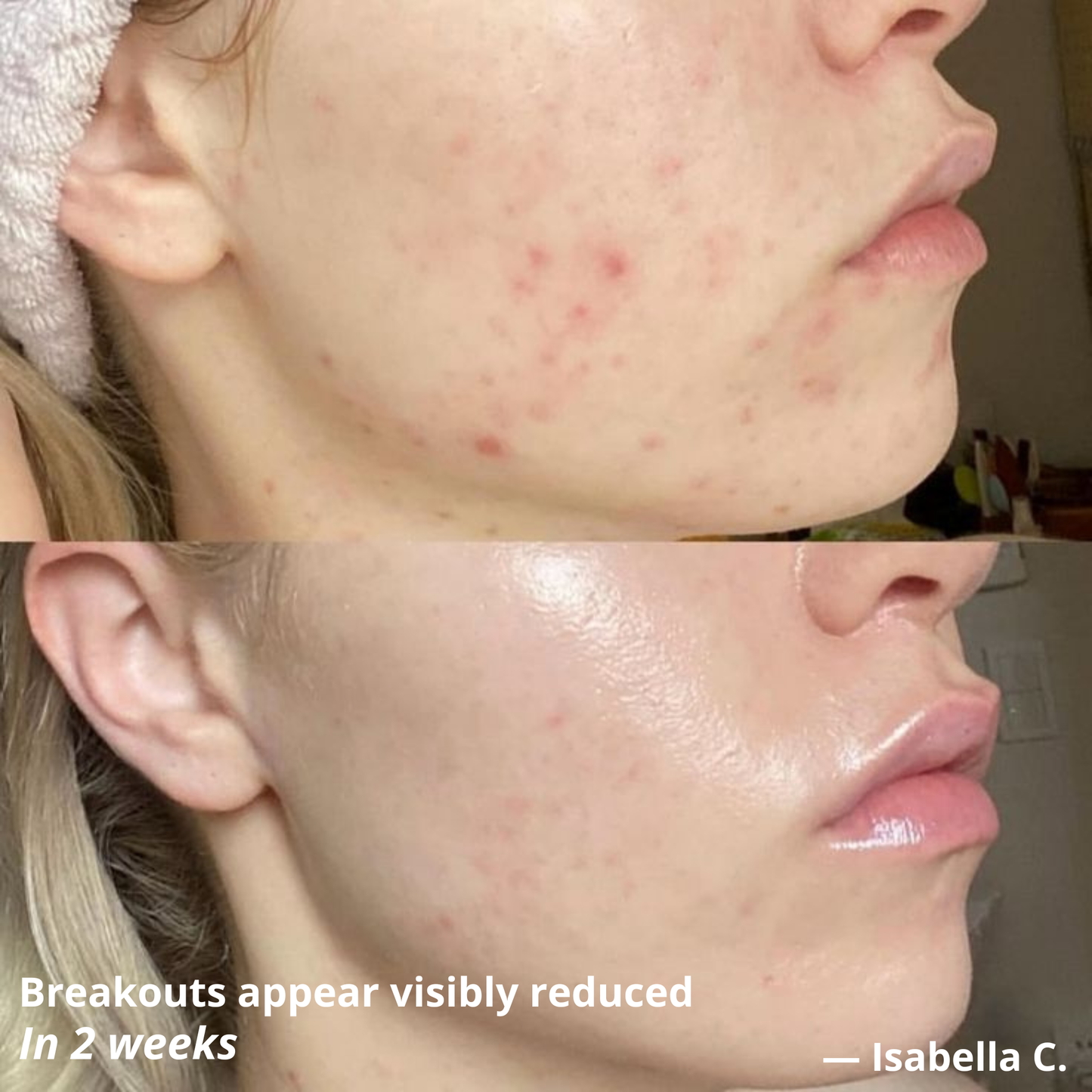 Centella Recovery Serum